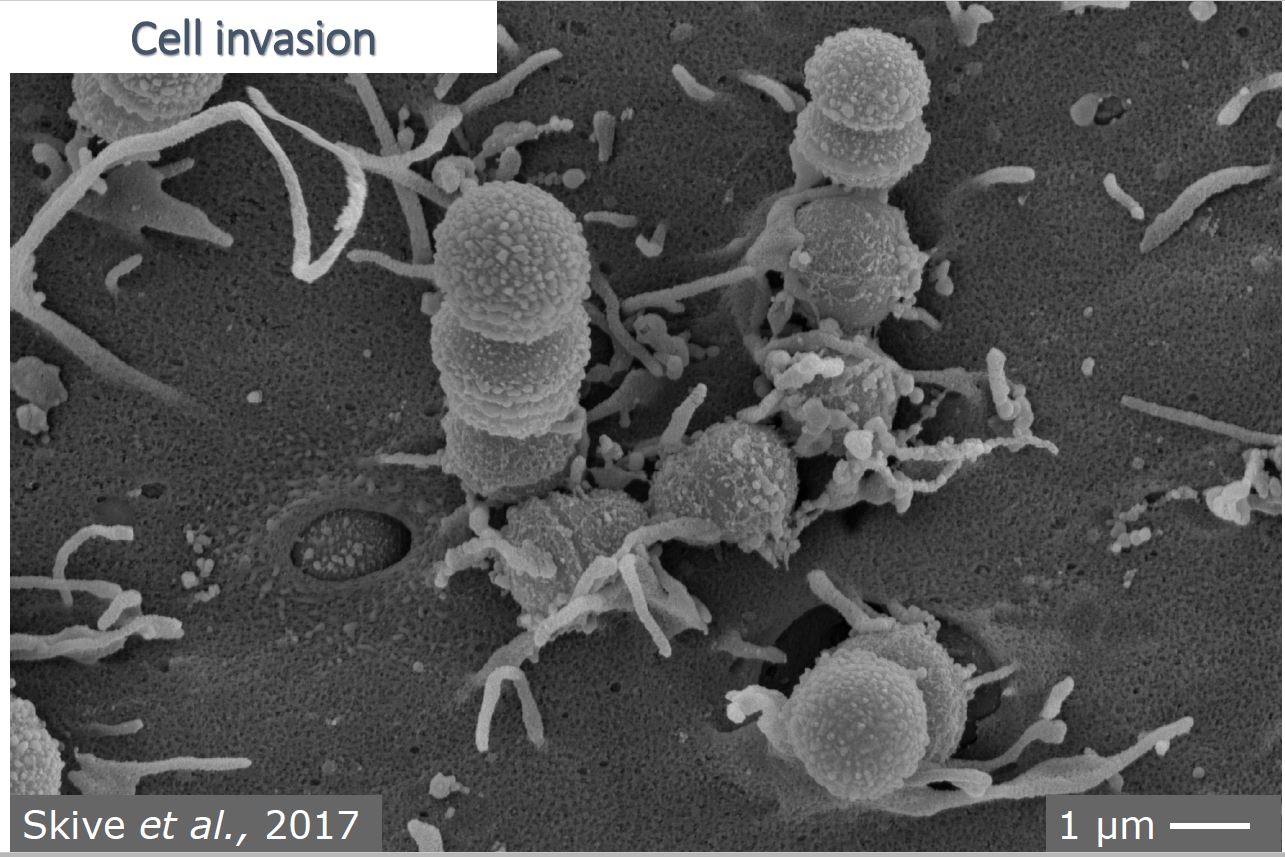 Invasión celular de estreptococos bajo microscopio